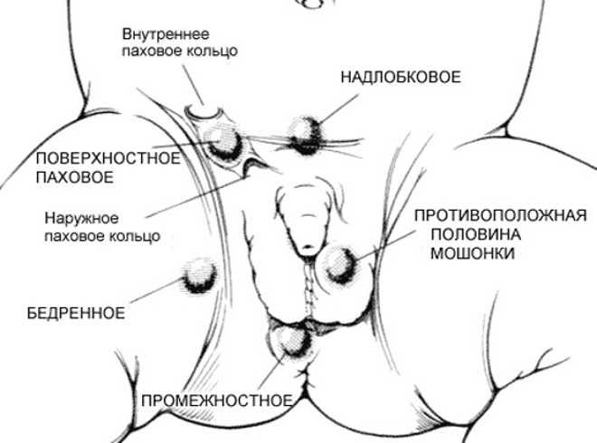 Простейшие чем лечить