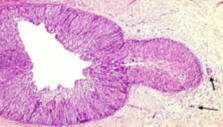 Pap-test