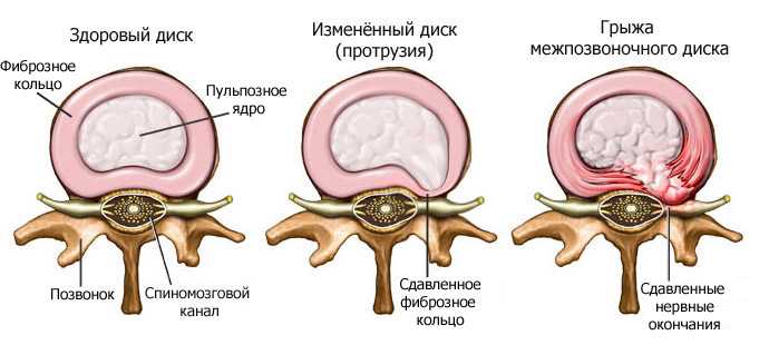 MD-Disk