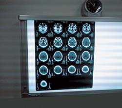 МРТ – преимущества магнитно-резонансной томографии