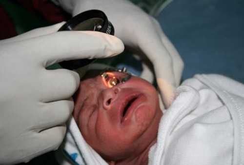 Исследование глаза новорожденного