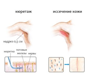 Лечение