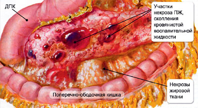 Структура поджелудочной железы