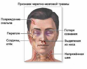 Черепно-мозговая травма