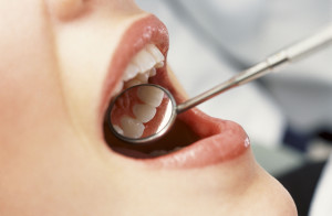 Клиновидные зубы – причины и лечение этого дефекта