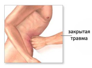 Инфицированная гематома брюшной полости thumbnail