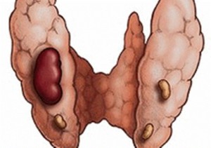 Vtlekkzhysq hfr