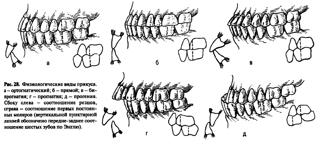 Виды прикусов физиологических, или нормальных