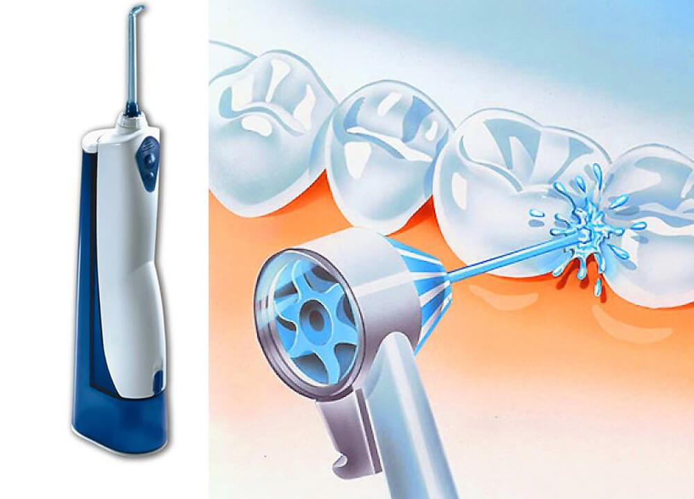 Виды ирригаторов для полости рта