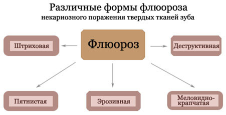 Виды флюороза зубов и осложнения