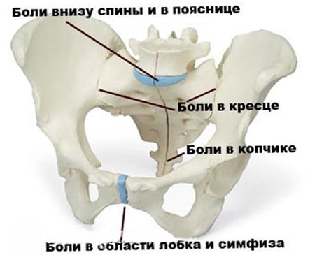 Диагностика симфизита при беременности