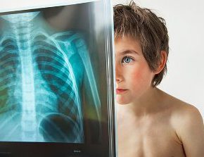 Можно ли делать рентген в детском возрасте - возраст, дозы, риски