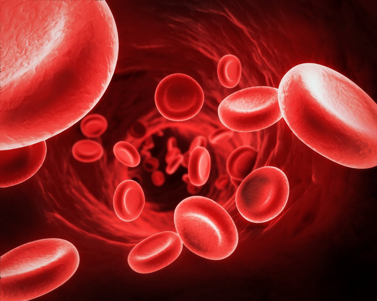 Диагностика и лечение ДВС синдрома - как нормализовать свертываемость крови