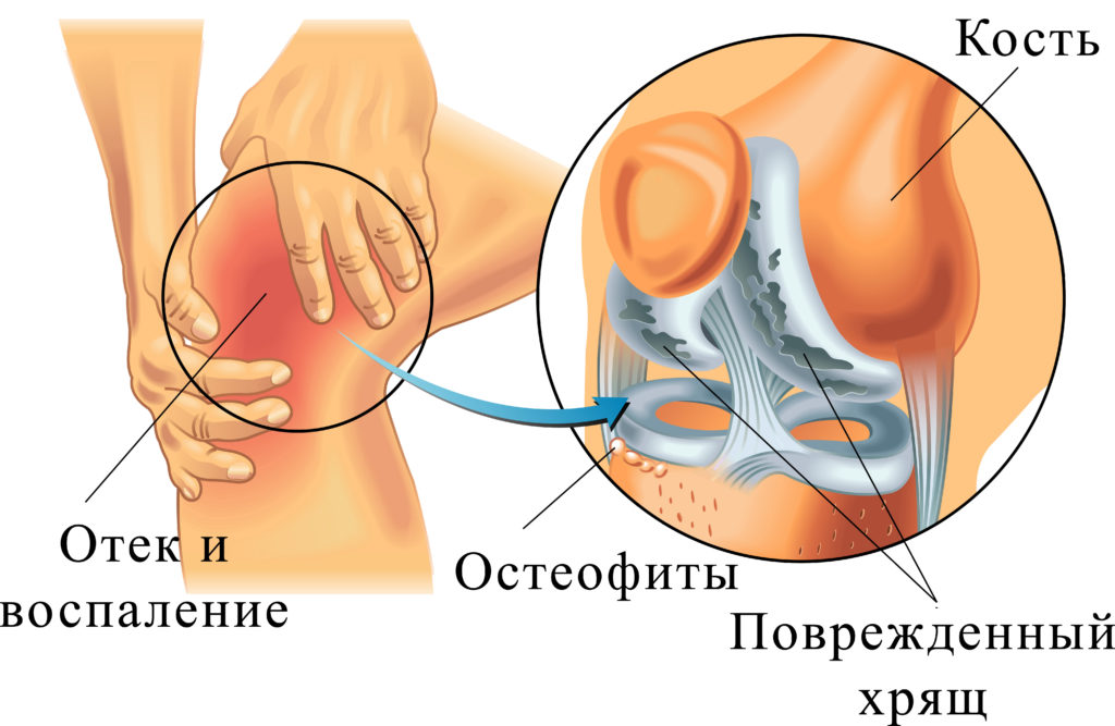 Аппарат АЛМАГ – что это такое и для чего используется?