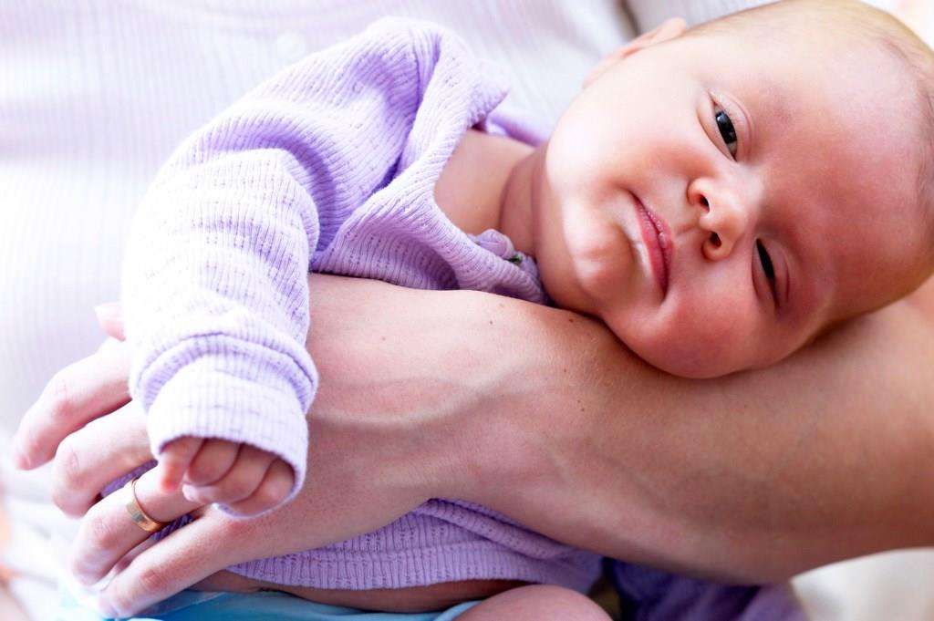 Виды и причины кривошеи у новорожденных и детей старше