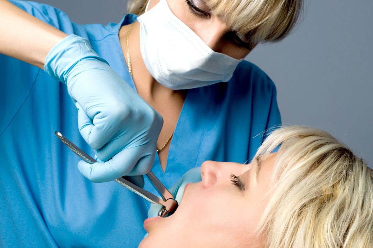 Альвеолит лунки после удаления зуба - причины, симптомы, лечение